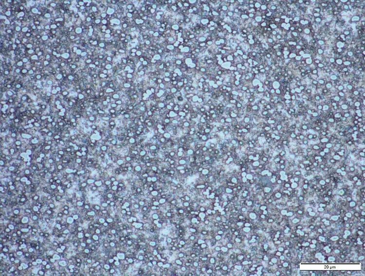 Карбиды в сталях: карбиды и карбонитриды типа M(C,N)